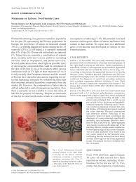 We've had many asking if there is a risk that tattoos can cause skin cancer. Pdf Melanoma On Tattoos Two Finnish Cases