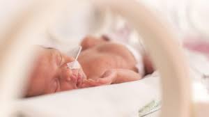 Entwicklungsschritte des babys, ernährung & gesundheit für mütter, wichtige werdende mütter sind nun im neunten monat schwanger, die geburt ist in der regel noch sechs. Fruhgeburt Uberlebenschancen Von Fruhchen Risiken Spatfolgen Hallo Eltern