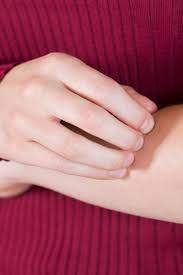This could be to food, a medicine that you took such as an a skin itch often comes before other symptoms such as skin rashes. Itching Without A Rash 8 Possible Causes And Treatments