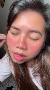 Christel Vidal Before and After