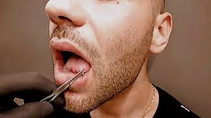 Snake eye 16g tongue rings piercing jewelry 20 piece value pack long shaft. Alex Bodypiercing Snake Eyes Piercing Youtube