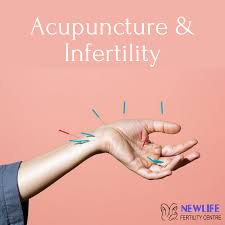 Fur Einige Frauen Ist Akupunktur Nicht Nur Ein Weg Um Stress Abzubauen Wenn Sie Versuchen Zu Empfang In 2020 How To Relieve Stress Acupuncture Accupuncture Fertility
