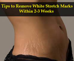 Pin On Skin Care