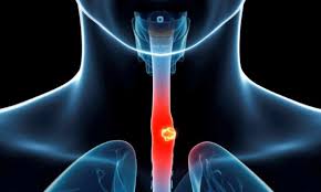 Maybe you would like to learn more about one of these? Like Thousands Of People Steve S Weight Plummeted Because He Simply Couldn T Eat Daily Mail Online