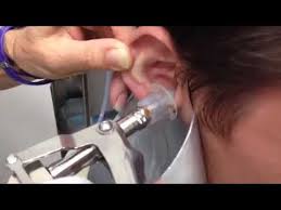 Maybe you would like to learn more about one of these? Scoatere Unui Dop De Ceara Din Ureche Youtube