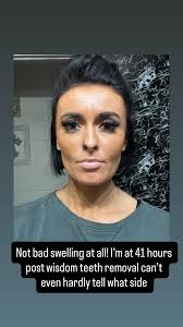 iwokeupinanewbugatti #newbugatti #bugatti #challenge #fyp #foryou  #foryourpage #trending #trend #viral