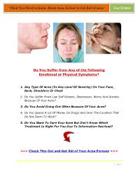 Some treatments help reduce them, but to get rid of all the comedons, you probably need a professional cleanup. Secrets To Get Rid Of Acne Fast