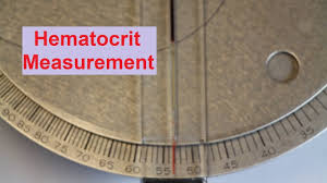 Hematocrit Measurement