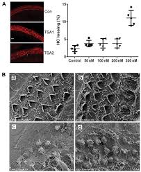 No one could tell except for me, and the only time i saw it was when washing my hair. Trichostatin A Reduces Cisplatin Induced Ototoxicity Through The Stat6 Signaling Pathway