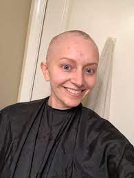 Patients who have suffered permanent, irreversible hair loss as the result of treatments with one advantage of taxotere over taxol is that the latter is administered weekly, while the former is given. Chemo And Hair Loss She Stays Strong