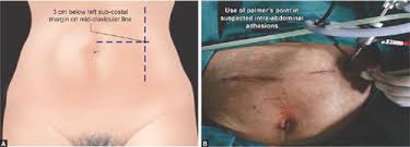 You can access the minimal access surgery tutorial for just £48.00 inc vat.uk prices shown, other nationalities may qualify for reduced prices.if this tutorial is part of the member benefit package, fellows, members, registered trainees and associates should sign in to access the tutorial. Jaypeedigital Ebook Reader