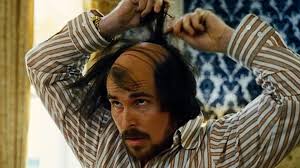 Scalp injections are one of the most commonly used treatments that dermatologists prescribe for hair loss. The Gq Doctor Help I M Losing My Hair British Gq British Gq
