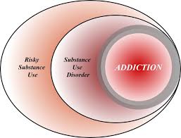 Addiction As A Brain Disease Revised Why It Still Matters And The Need For Consilience Neuropsychopharmacology