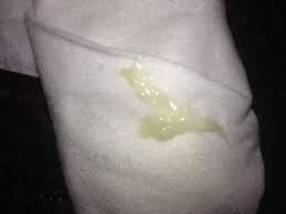 Servible Y Rudimentario Essay De Entorpercimiento Hogareno Del Flujo Vaginal Flujo Amarillo En El Embarazo Primeras Semanas