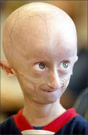 Maybe you would like to learn more about one of these? Pin On Medical Anomalies