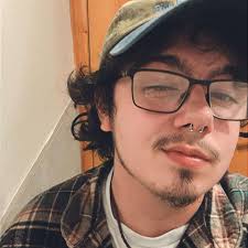 Has anyone tried finasteride or minoxidil for hair loss?