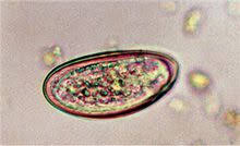 Folgende nahrungsmittel sind natürliche wurmmittel und erlauben die beseitigung der parasiten, empfohlen werden: Parasiten Da Steckt Der Wurm Drin Pz Pharmazeutische Zeitung