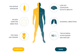 When symptoms are present, some are subtle while others are hard to ignore. Pulsenotes Dka Notes