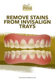 If you use denture cleaners and notice your invisalign aligners starting to turn a little yellow, discontinue use and contact your dentist or orthodontist. How Often To Use Retainer Brite On Invisalign Arxiusarquitectura