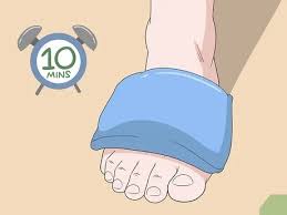 Tendonitis affecting the extensor tendons on the top of the foot is usually caused by the foot rubbing against the shoe or, less frequently, inflammatory conditions such as rheumatoid arthritis. How To Treat Extensor Tendonitis 11 Steps Wikihow