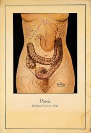 The Sick Rose Disease And The Art Of Medical Illustration Pdf Displaced Colon Vintage Medical Illustration Scientific Illustration Male Figure Drawing Medical Art