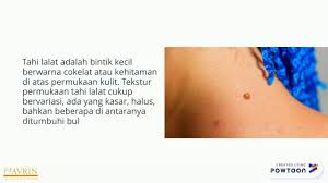 Cara Menghilangkan Tahi Lalat Hidup Di Wajah Tanpa Efek Samping Navrina Dengan Gambar Wajah Kulit Hidup