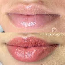 Julia Franciosi Dermos On Instagram Baby Lips E A Tecnica De Revitalizacao Labial Que Corrige Tons Escuros E Colore Com Naturalidade Labial Instagram Julia