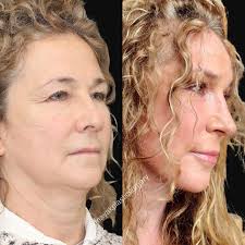 Omakase: “I'll leave it up to you!” Omakase (お任せ) is a Japanese phrase,  used when ordering in sushi restaurants. It means “I'll leave it up to  you.” Omakase is based