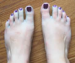 See the before and after photos for yourself! Sarah Jane S Craft Blog As Seen On Pinterest Vinegar And Listerine Foot Soak