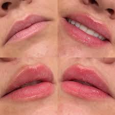 Nadia Ryan RN, BSN (@nadiaryan.rn) • Instagram photos and videos