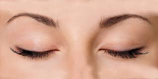 Image result for xantelasma