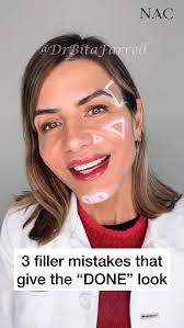 undereyefiller #undereyehollows #teartroughfiller #teartrough  #drbitafarrell #naturalaestheticscenter