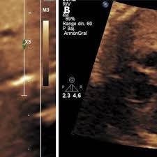 E. Cazorla's research works