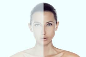 The excess bones and soft tissues (fat, muscles) will be exposed by an incision inside the mouth and then be carefully removed or cut off. The Straight Facts On Facial Asymmetry Is Surgery An Option