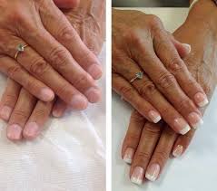 Puis, cette capsule, carrée ou en forme d'amande, est fixée à l'ongle grâce à la résine ou au gel. Faux Ongles Gel Resine Fench Faux Ongles Gel Faux Ongles Ongles