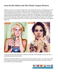 Lana del ray before and after . Lana Del Rey Before And After Plastic Surgery Pictures By Uttermostfolks265 Issuu