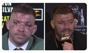 Ddp after a fight with the "pillow fisted jab merchant" vs after a fight  with "KO artist contender izzy"