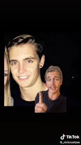 El resultado de no lavarse el pelo durante 6 años para detener la calvicie 