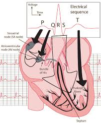 Cardiac Ecg