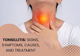 Image result for Tonsillitis