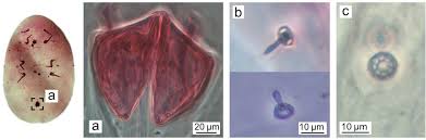 Image result for Chassalia umbraticola