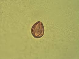 Image result for Dialium englerianum