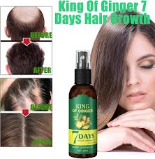 Shouga Kingu Hair Growth Oil, King of Ginger 7 Days Hair Growth, Shougagro  Japanese Hair Growth Spray, Ginger Oil for Hair Growth, Anti-Hair Loss Oil  (1Pcs) : Amazon.co.uk: Beauty