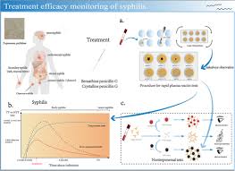Image result for Treponemal Specific Test