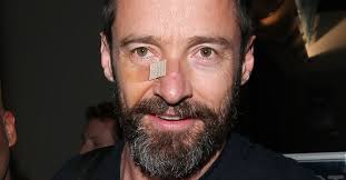 Celebrities Who Survived Cancer