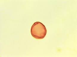 Image result for Chaetachme