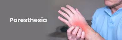 Image result for Paresthesia