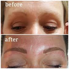Beauty ink® by shauna magrath c.p.c.p. Cosmetic Tattooing Microblading Sage Spa Day Spa Medispa Laser Treatments