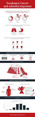 Exposure to asbestos can also increase a person&#x27;s risk for developing lung, gallbladder, throat, kidney, esophagus, breast, and prostate cancer, as well as lymphomas and leukemia. Esophagus Cancer And Asbestos Exposure Infographic Elg Law