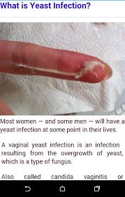 It does sound like a yeast infection because hormone levels. What Is A Yeast Infection 87 Zanr Lavanda Galery Ru